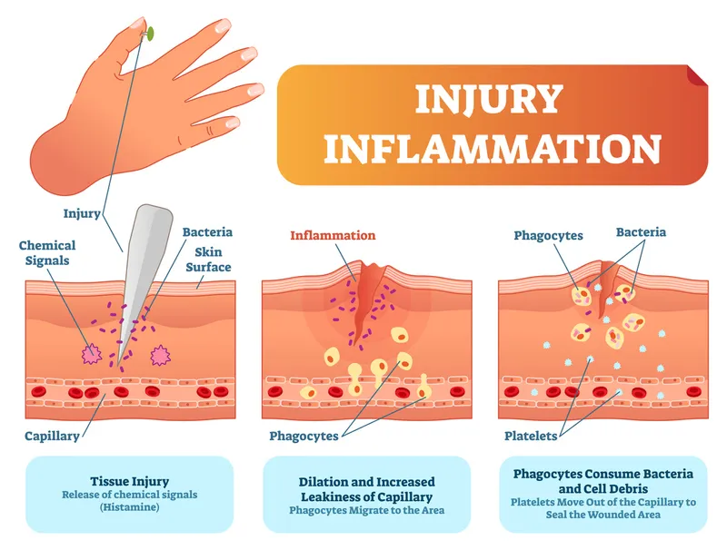 The Inflammatory response
